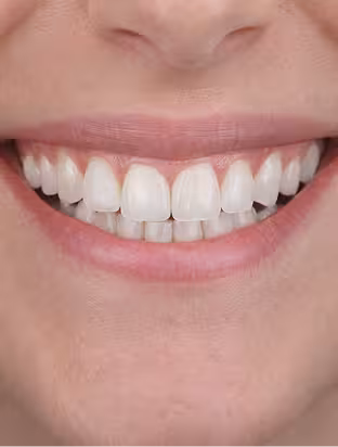 Cosmetic Dentistry@1.2x_converted