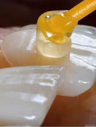 Porcelain Veneers@1.2x_converted